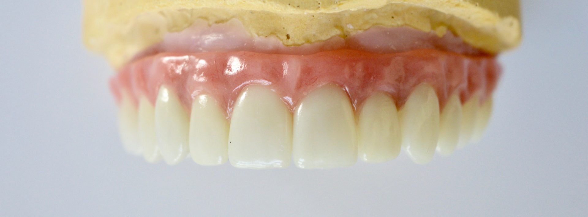 Dental Lab Pittsburgh