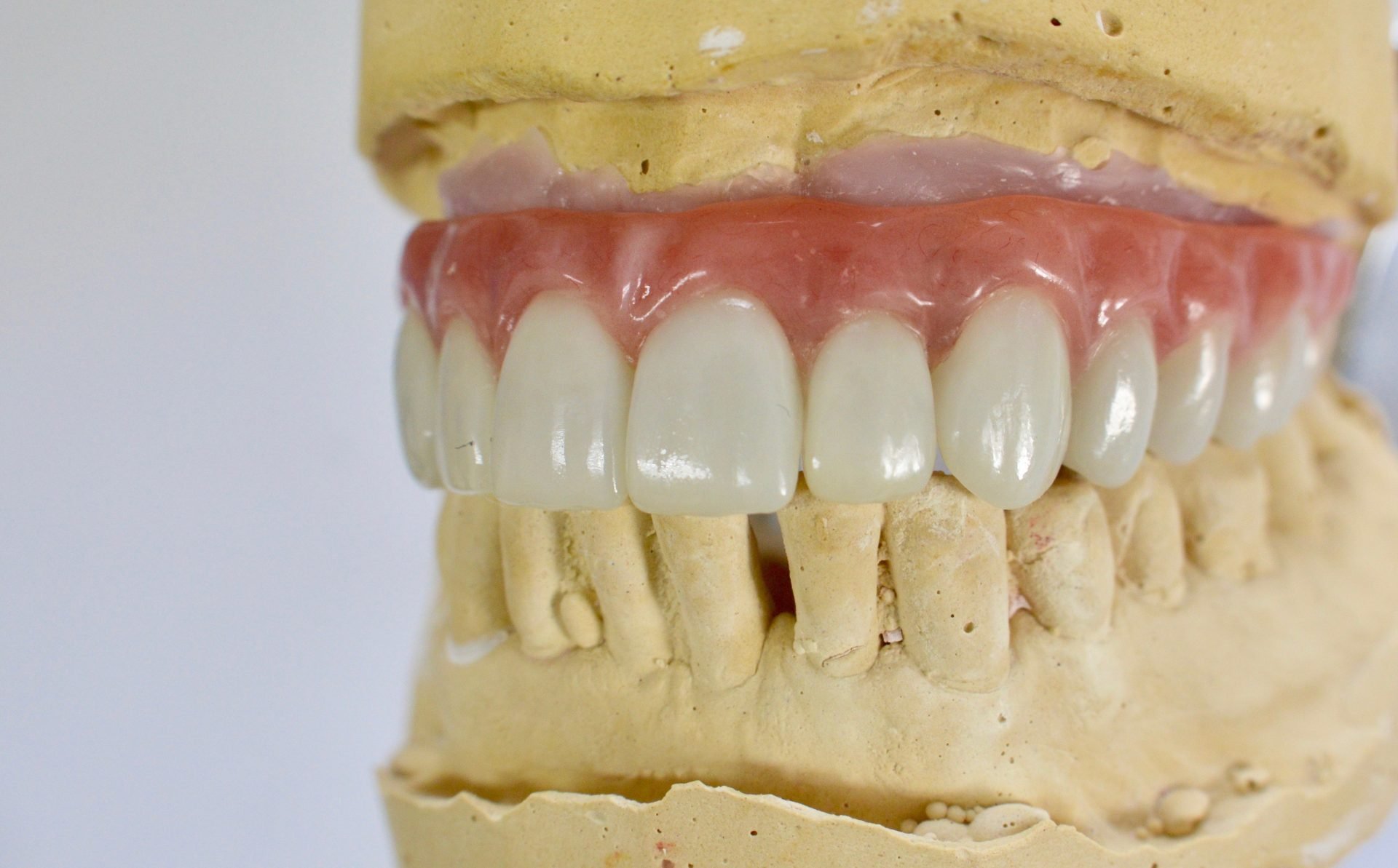 Dental Lab in Pittsburgh