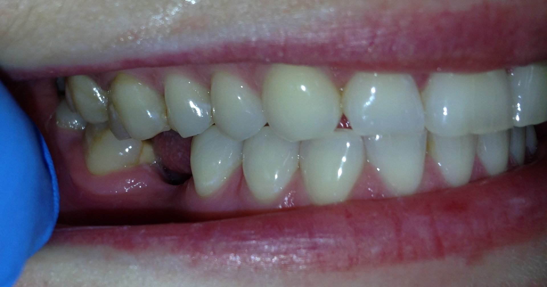 Dental Lab in Pennsylvania