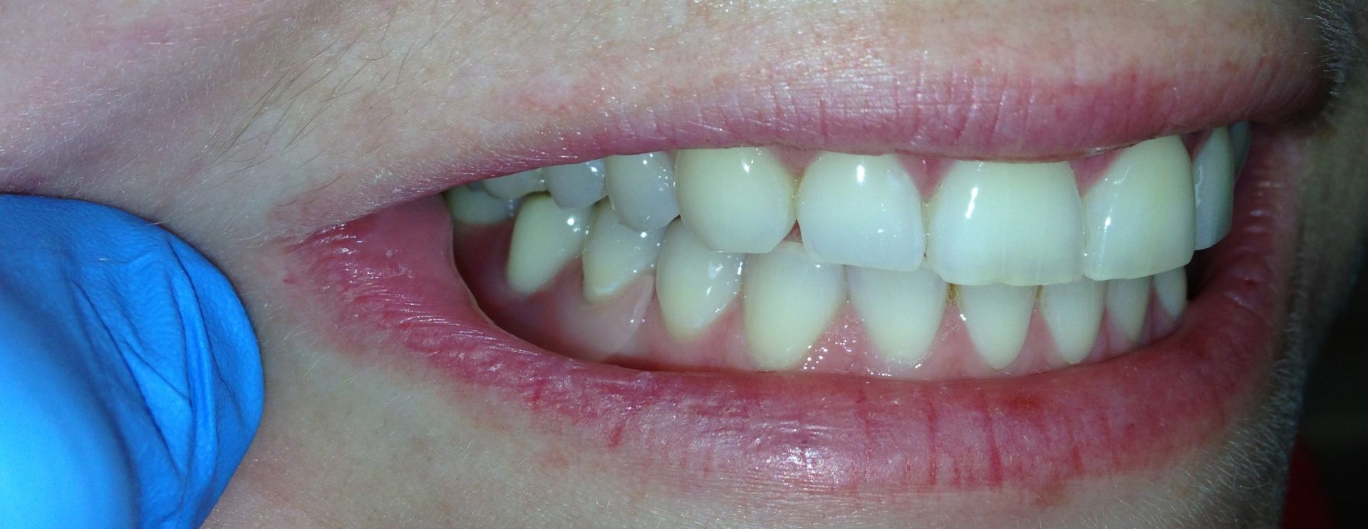 Dental Lab in Pennsylvania