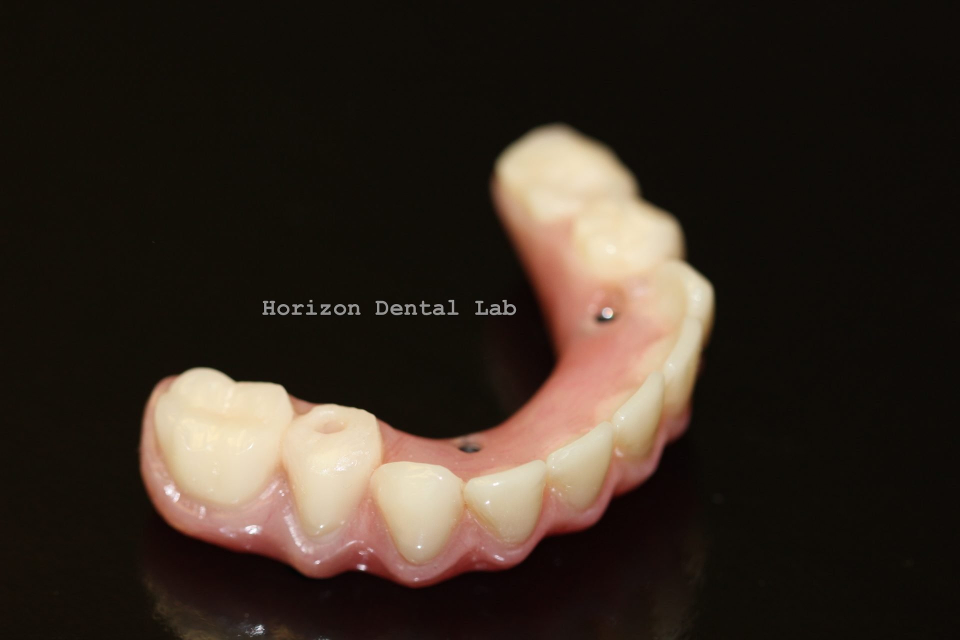 3D Printed Dental Prosthetics in Pennsylvania