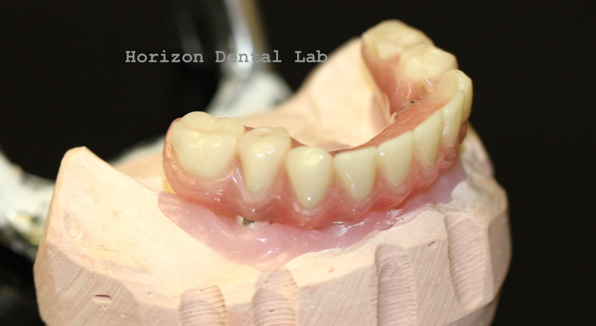 Dental Lab in Pittsburgh