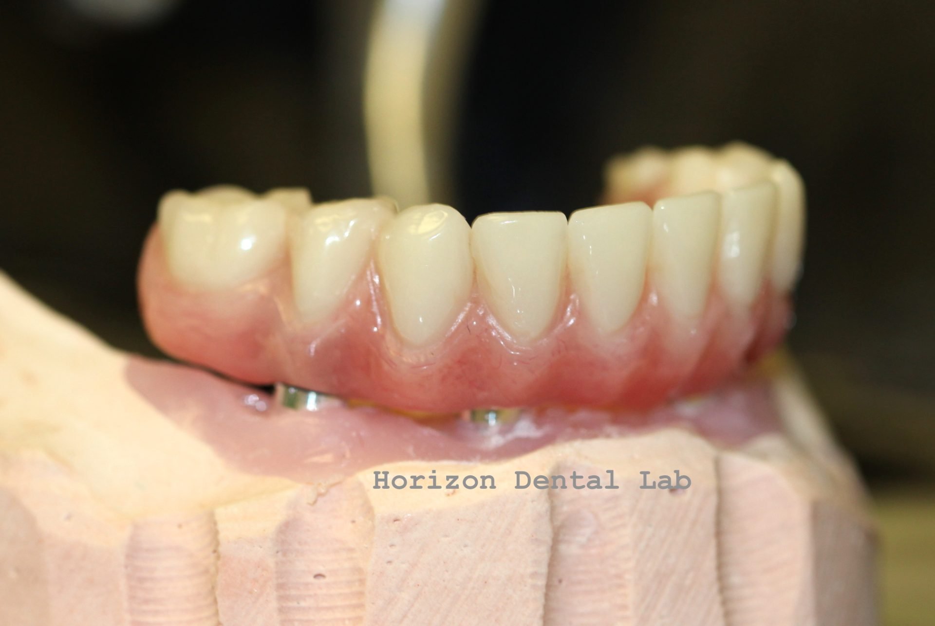 Dental Lab in Pennsylvania