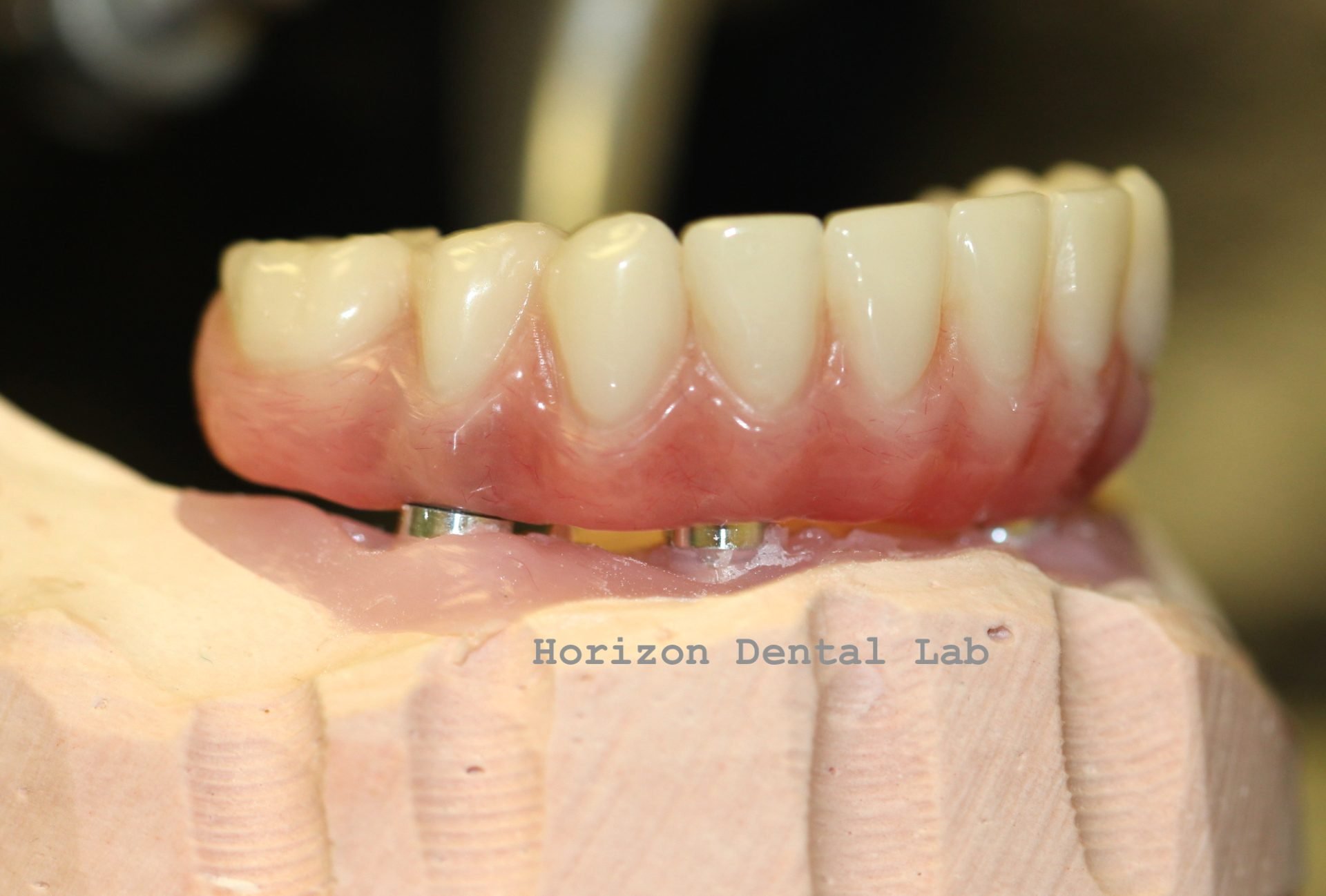 Dental Lab Pittsburgh