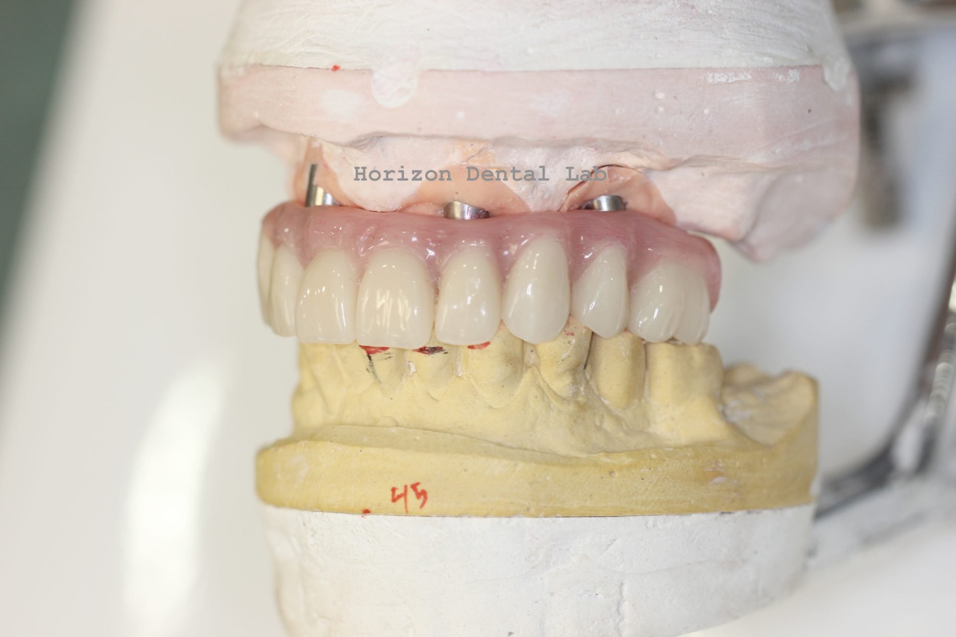 Dental Lab in Pennsylvania