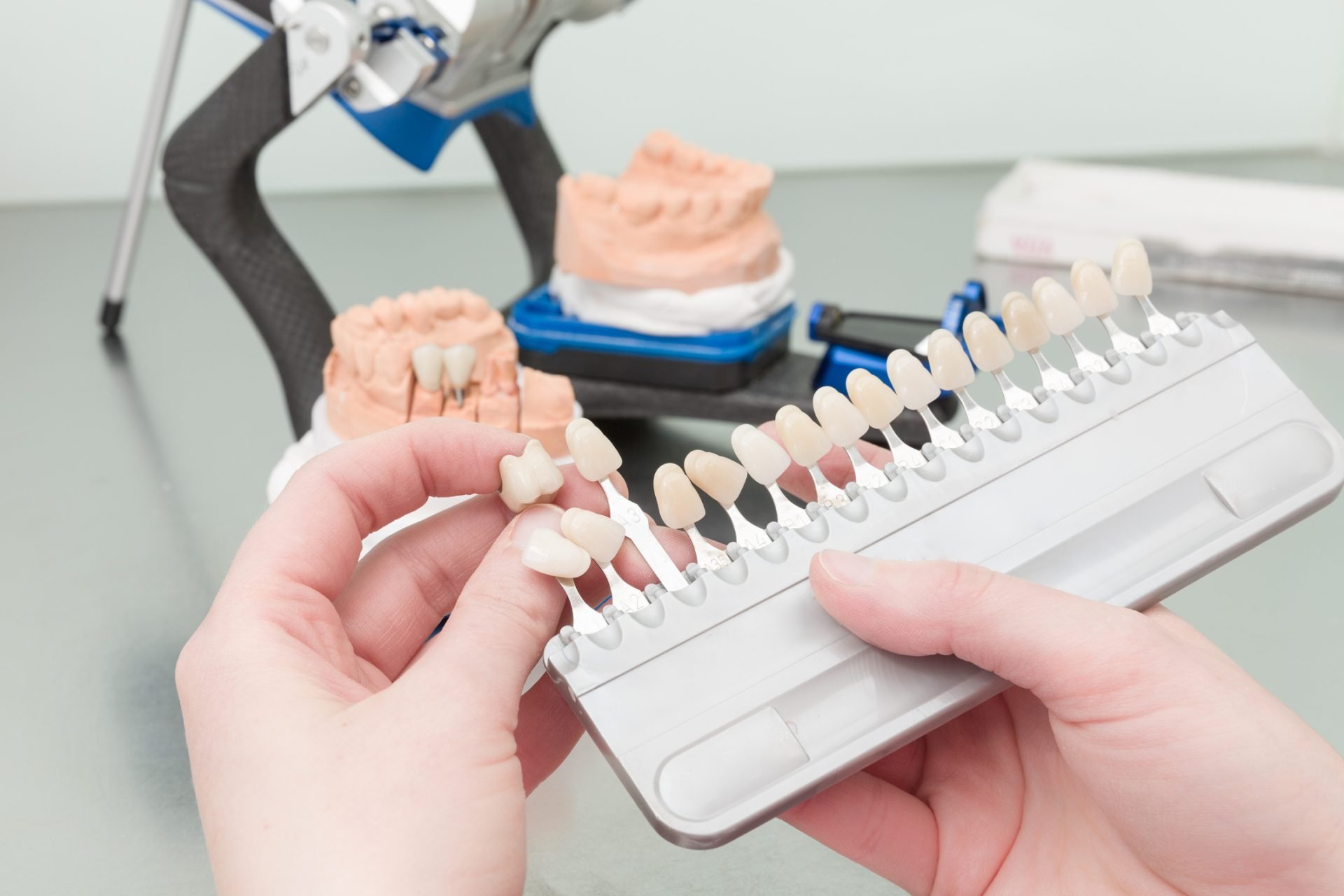 Custom Dental Prosthetics in Pennsylvania