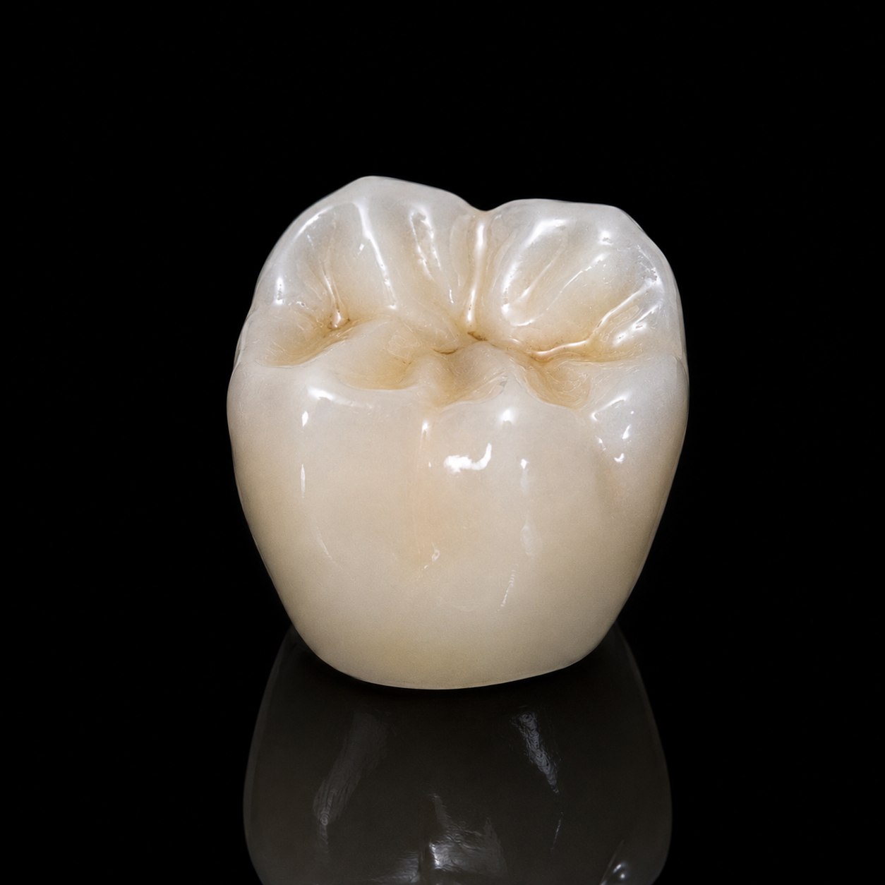 Crowns & Bridges dental prosthesis fabricated by Horizon Dental Lab, Warminster PA - zirconia crown restoration showing precise margins and natural aesthetics