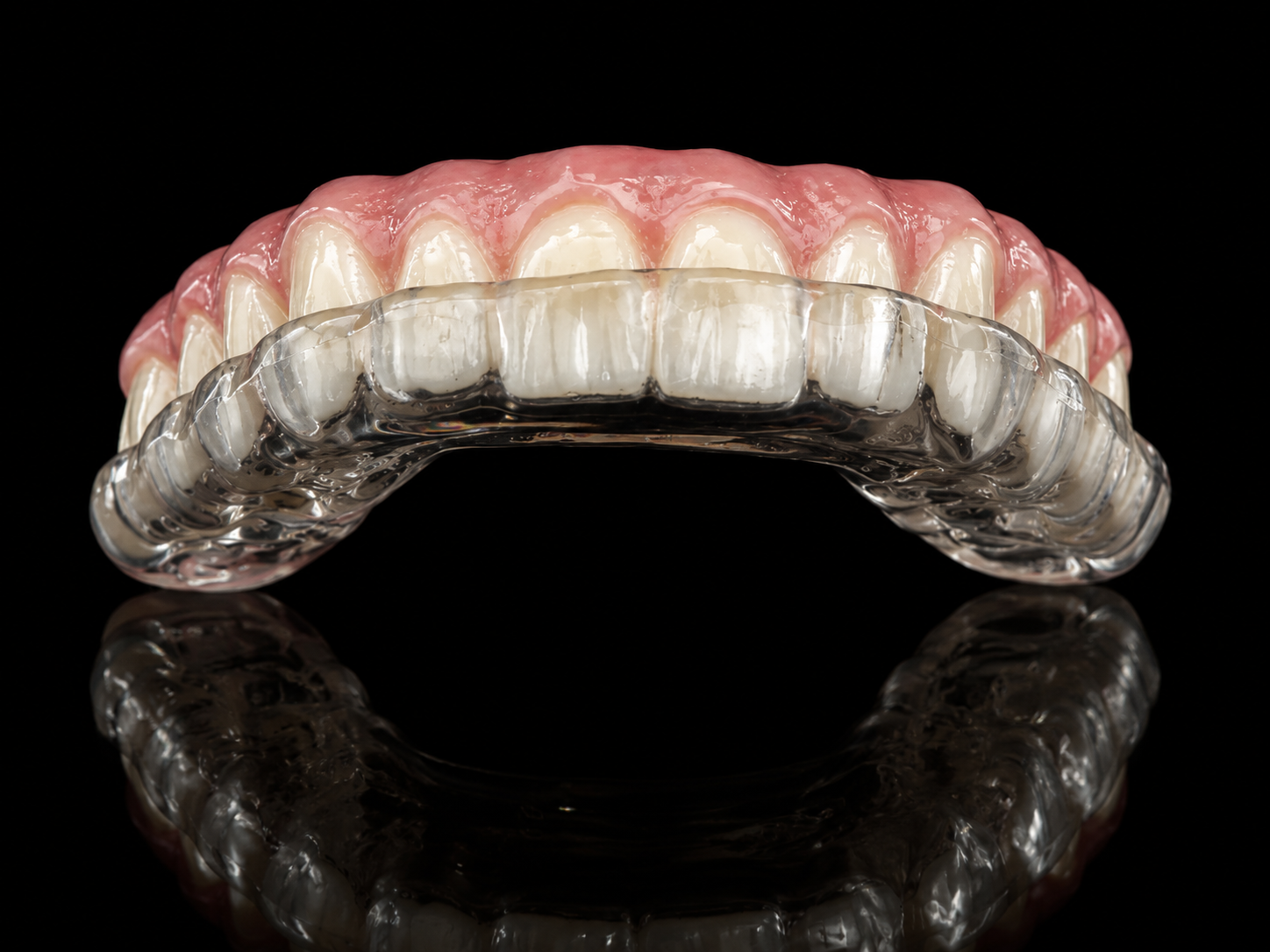 Night Guard & Retainers dental prosthesis fabricated by Horizon Dental Lab, Warminster PA - hard acrylic night guard for bruxism protection