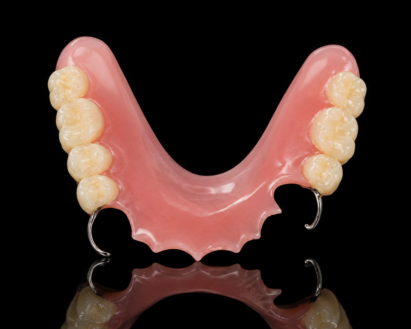 Cast Framework Partial dental prosthesis fabricated by Horizon Dental Lab, Warminster PA - acrylic partial denture with wrought wire clasps demonstrating clasp retention